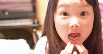 どうして歯が動くの?矯正治療と体の仕組み